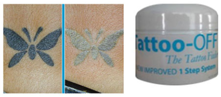 Tattoo Off Tattoo removal cream review