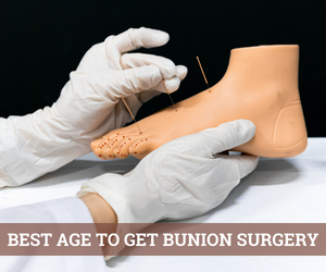 Best Age to Get Bunion Surgery