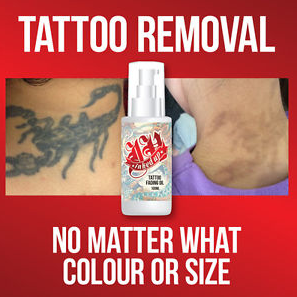 Inked Up best Tattoo Removal Cream